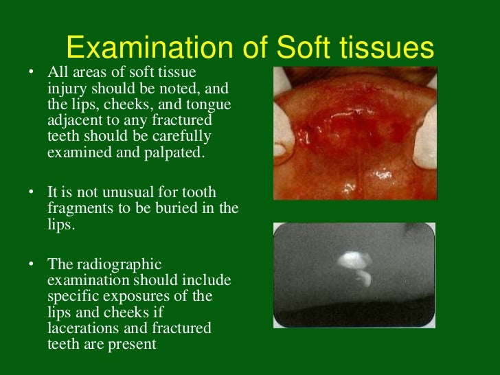 Free furry sex Oral facial soft tissue exam record